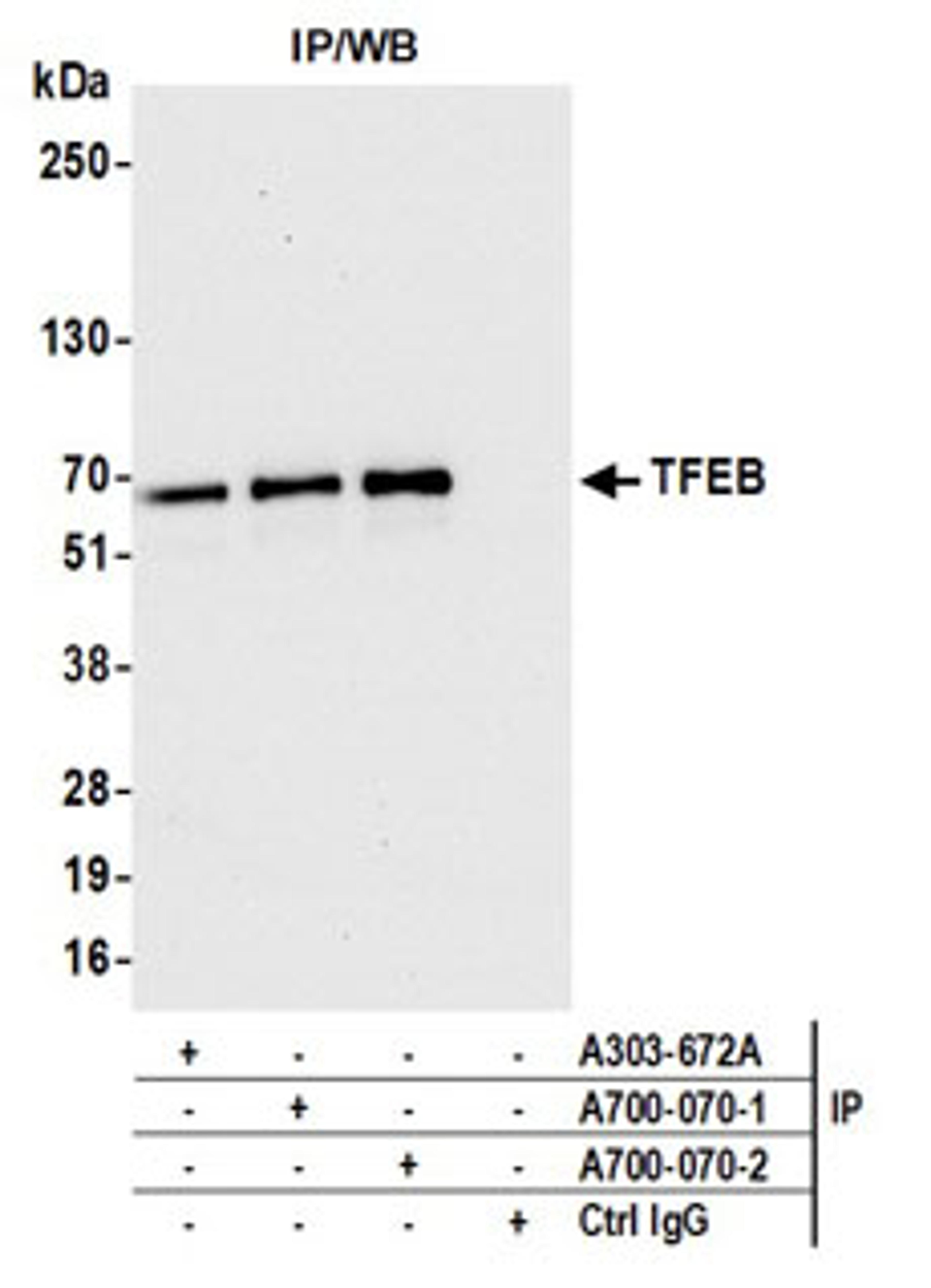 Detection of human TFEB by western blot of immunoprecipitates.