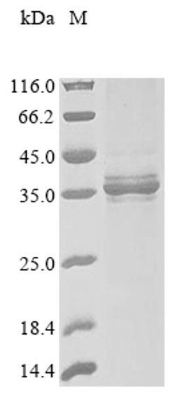 (Tris-Glycine gel) Discontinuous SDS-PAGE (reduced) with 5% enrichment gel and 15% separation gel.