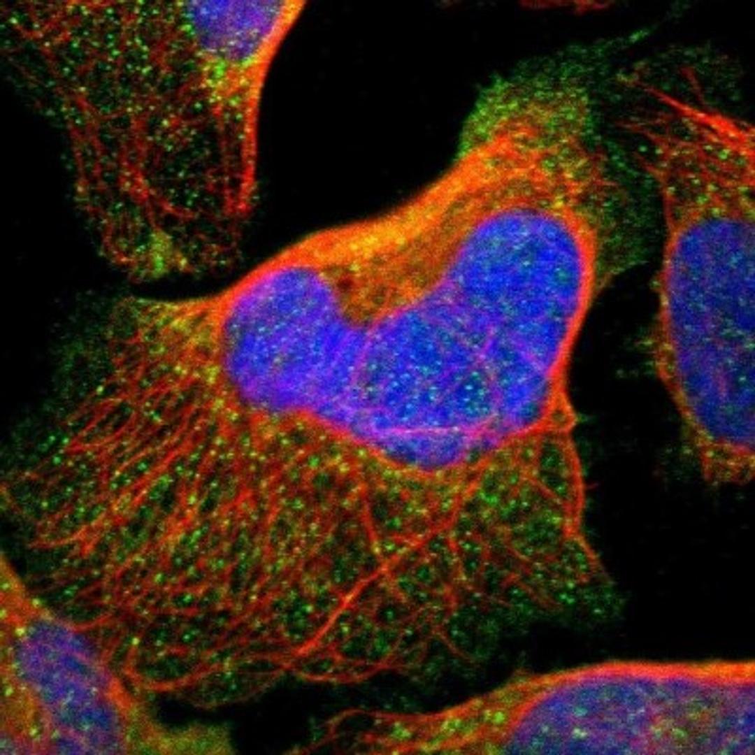 Immunocytochemistry/Immunofluorescence: RNF149 Antibody [NBP1-83440] - Staining of human cell line U-2 OS shows positivity in plasma membrane & vesicles.