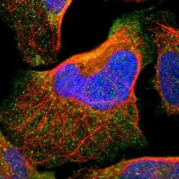 Immunocytochemistry/Immunofluorescence: RNF149 Antibody [NBP1-83440] - Staining of human cell line U-2 OS shows positivity in plasma membrane & vesicles.