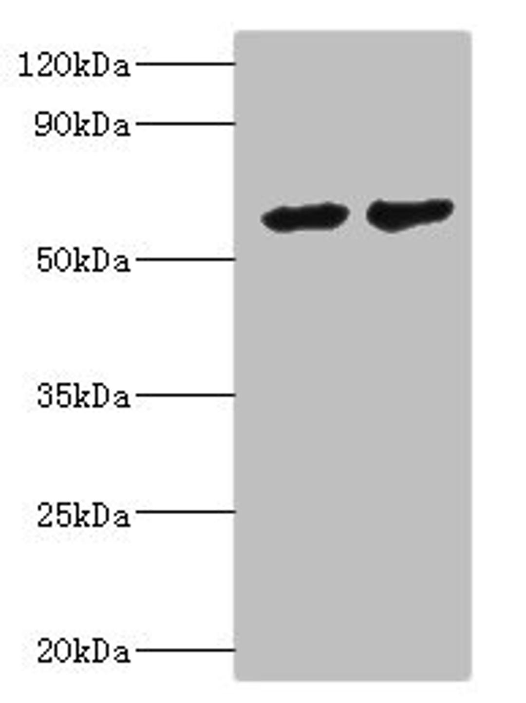 Western blot. All lanes: CYP4F12 antibody at 6ug/ml. Lane 1: Mouse small intestine tissue. Lane 2: Rat liver tissue. Secondary. Goat polyclonal to rabbit IgG at 1/10000 dilution. Predicted band size: 61, 12 kDa. Observed band size: 61 kDa.
