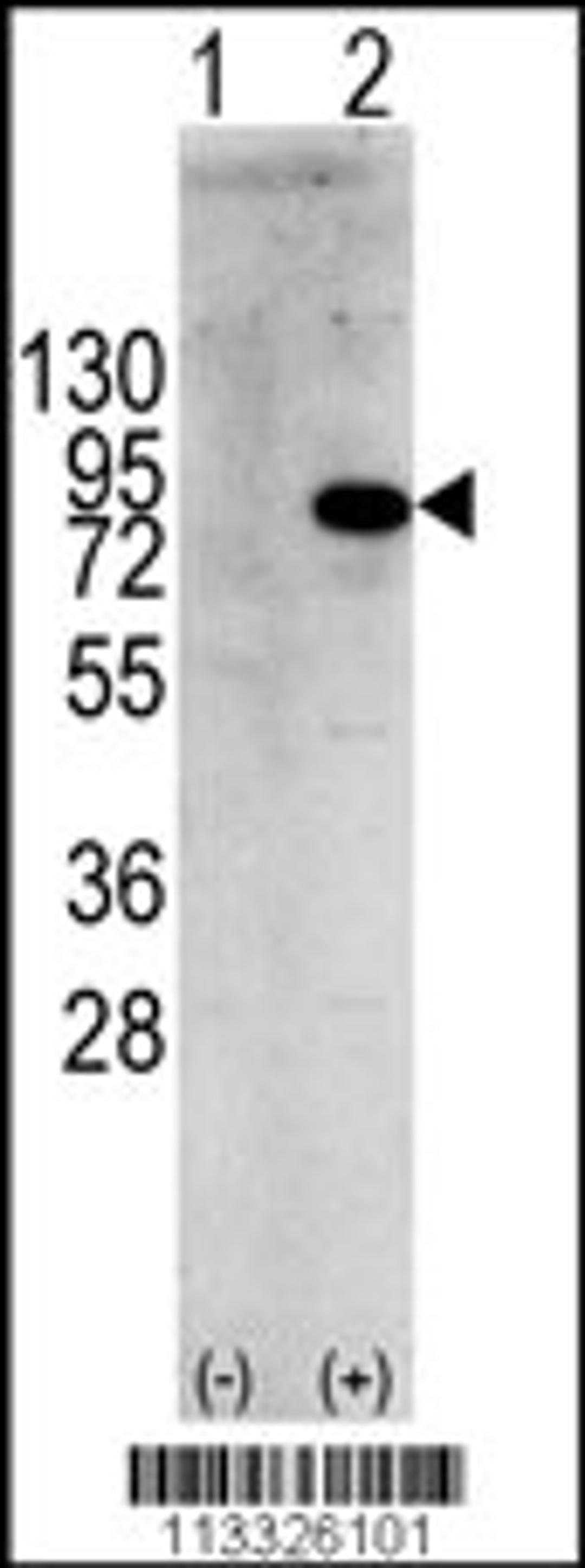 Western blot analysis of PIK3R1 using rabbit polyclonal PIK3R1 Antibody (Y580) using 293 cell lysates (2 ug/lane) either nontransfected (Lane 1) or transiently transfected with the PIK3R1 gene (Lane 2).