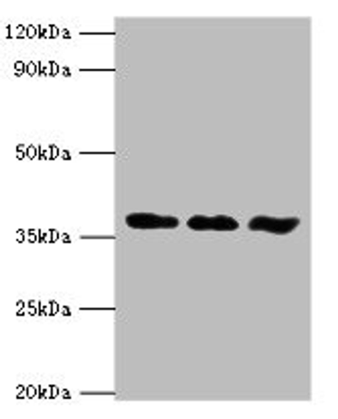 Western blot. All lanes: ACVR1 antibody at 6ug/ml. Lane 1: A549 whole cell lysate. Lane 2: HepG2 whole cell lysate. Lane 3: Mouse gonad tissue. Secondary. Goat polyclonal to rabbit IgG at 1/10000 dilution. Predicted band size: 39 kDa. Observed band size: 39 kDa.