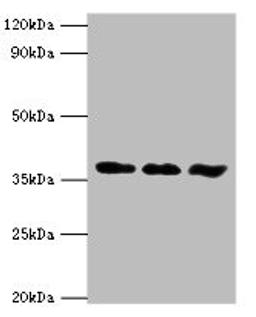 Western blot. All lanes: ACVR1 antibody at 6ug/ml. Lane 1: A549 whole cell lysate. Lane 2: HepG2 whole cell lysate. Lane 3: Mouse gonad tissue. Secondary. Goat polyclonal to rabbit IgG at 1/10000 dilution. Predicted band size: 39 kDa. Observed band size: 39 kDa.