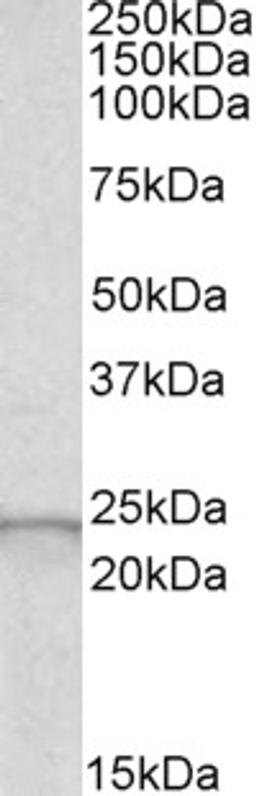 45-682 staining (0.5ug/ml) of Human Liver lysate (RIPA buffer, 30ug total protein per lane). Primary incubated for 1 hour. Detected by chemiluminescence.