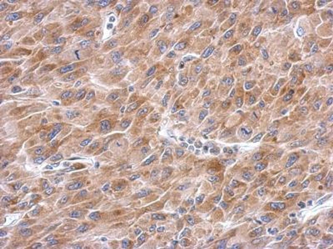 Immunohistochemistry-Paraffin: Asparagine synthetase Antibody [NBP2-14879] - Paraffin-embedded U87 xenograft, using antibody at 1:500 dilution.