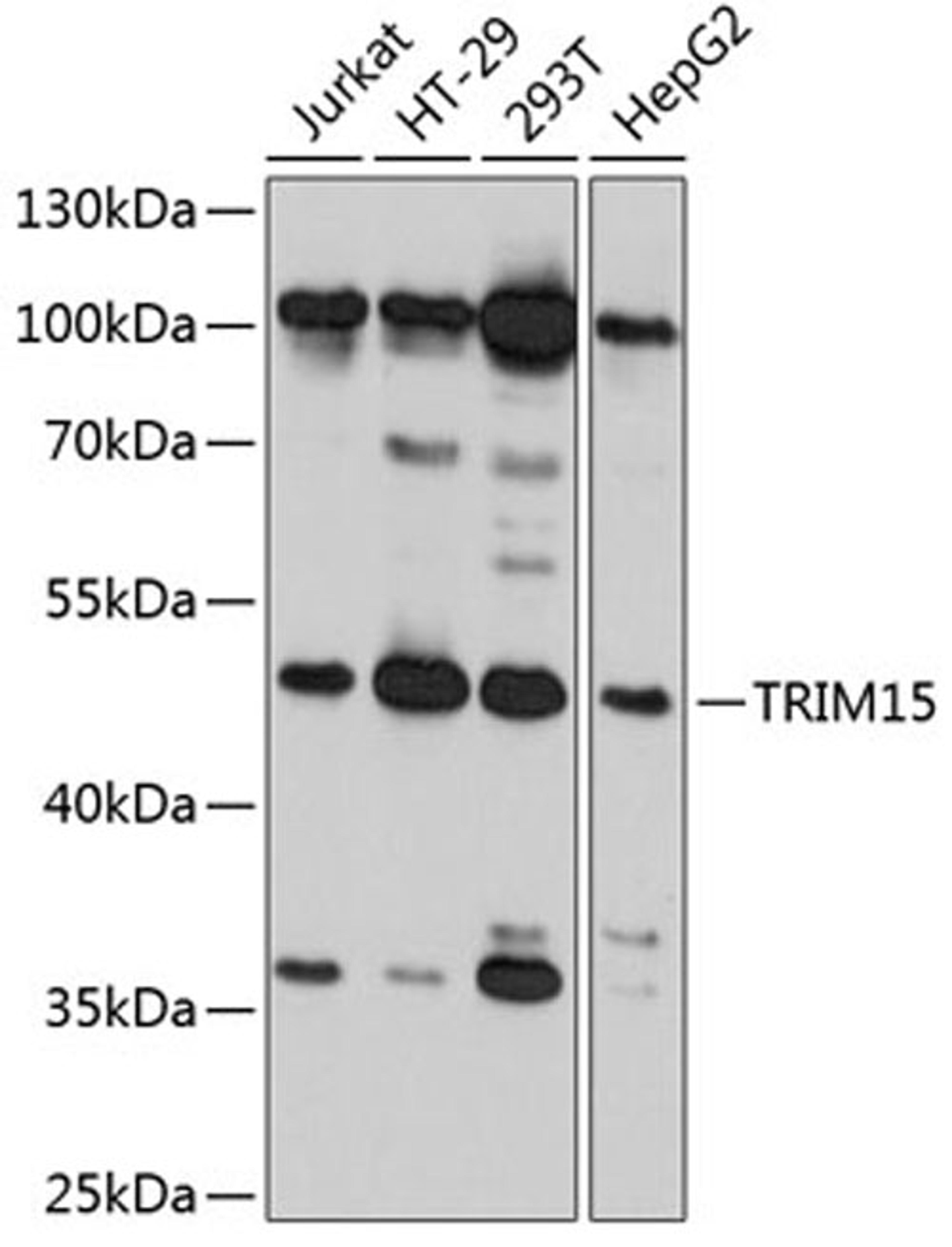 Western blot - TRIM15 antibody (A11730)