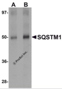 Western blot analysis of SQSTM1 in Human spleen tissue lysate with SQSTM1 antibody at (A) 1 and (B) 2 &#956;g/mL. 