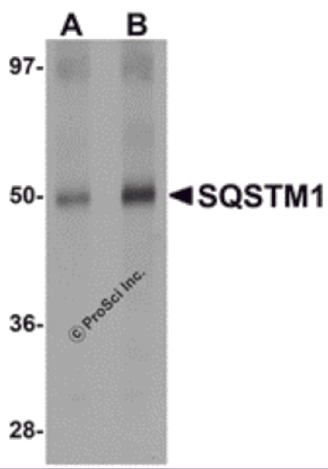 Western blot analysis of SQSTM1 in Human spleen tissue lysate with SQSTM1 antibody at (A) 1 and (B) 2 μg/mL.