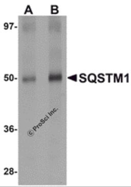 Western blot analysis of SQSTM1 in Human spleen tissue lysate with SQSTM1 antibody at (A) 1 and (B) 2 μg/mL.