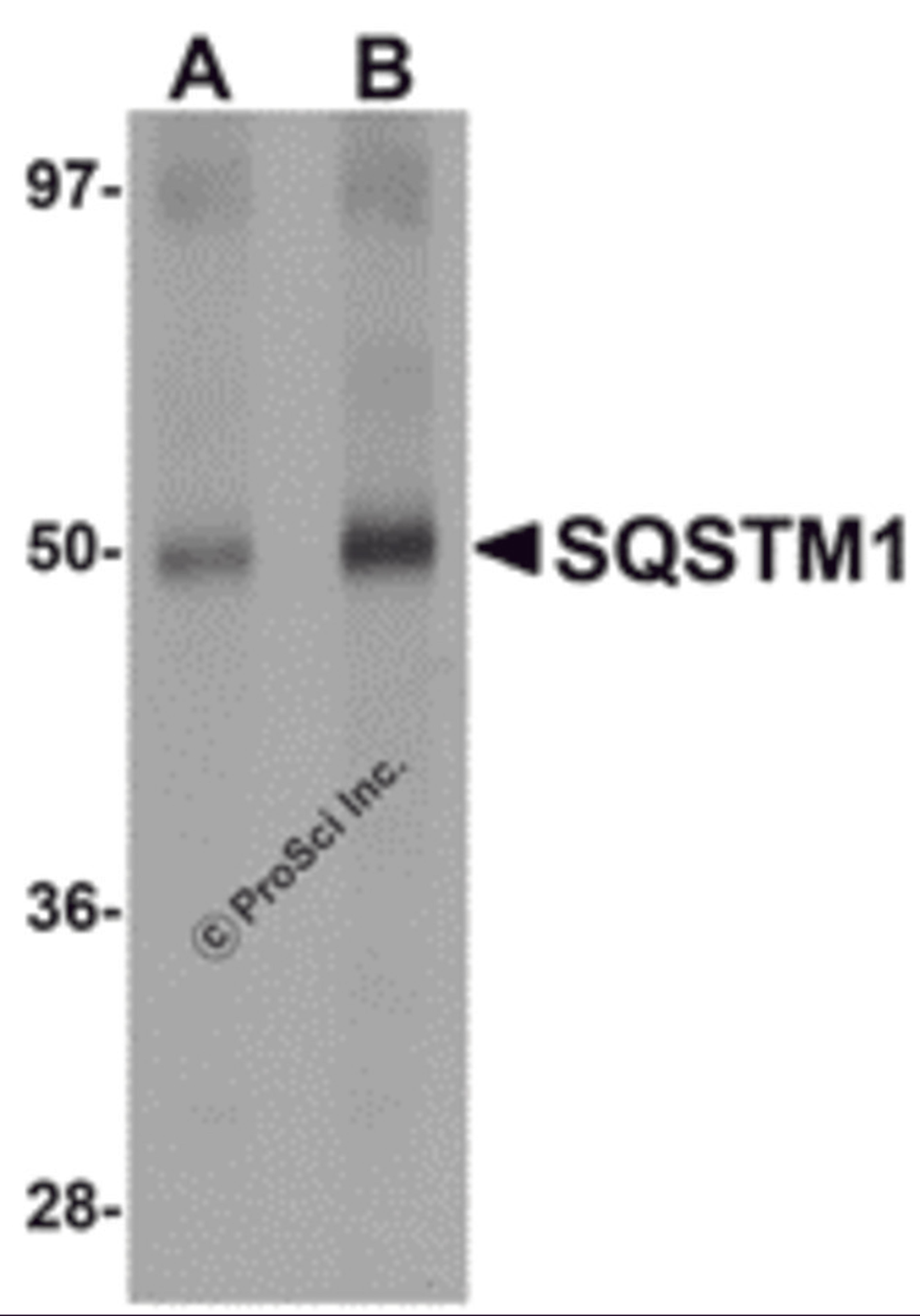 Western blot analysis of SQSTM1 in Human spleen tissue lysate with SQSTM1 antibody at (A) 1 and (B) 2 μg/mL.