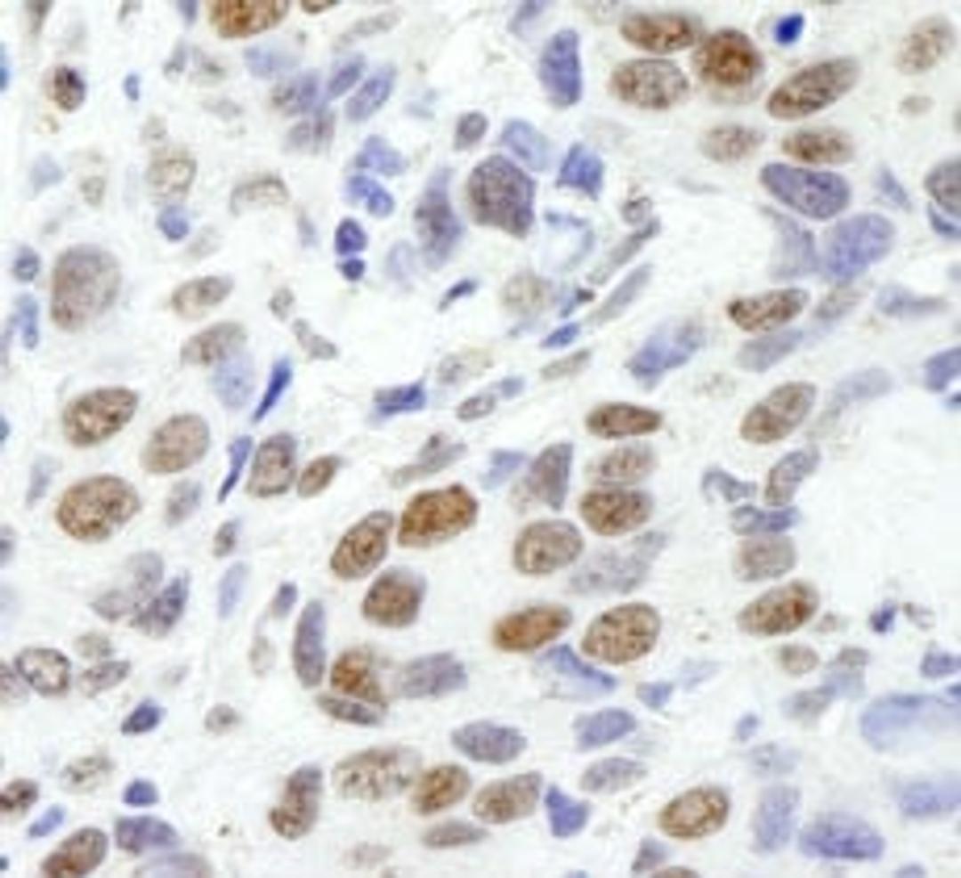 Detection of human EWS by immunohistochemistry.