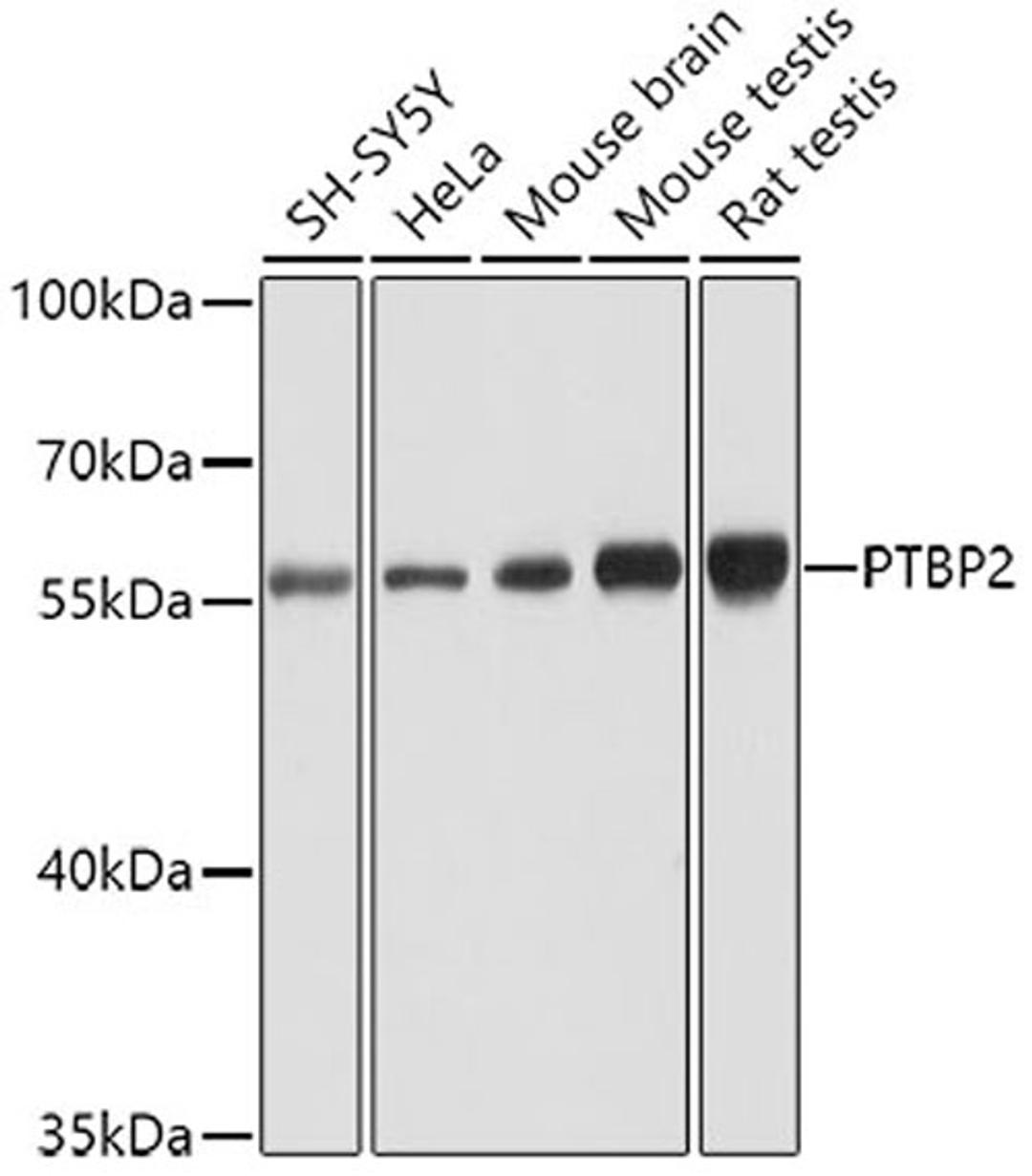 Western blot - PTBP2 antibody (A6054)