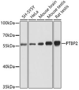 Western blot - PTBP2 antibody (A6054)