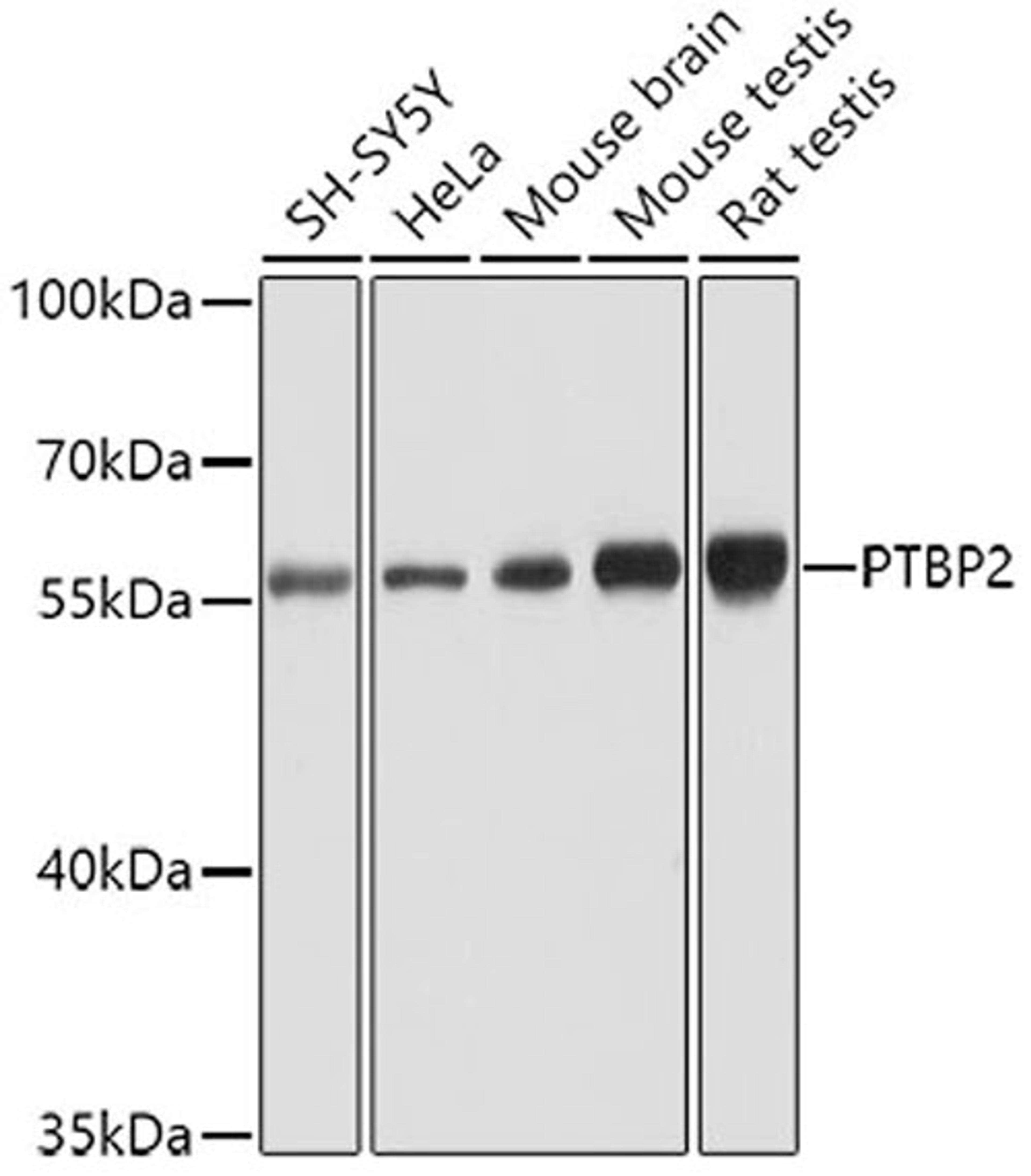 Western blot - PTBP2 antibody (A6054)