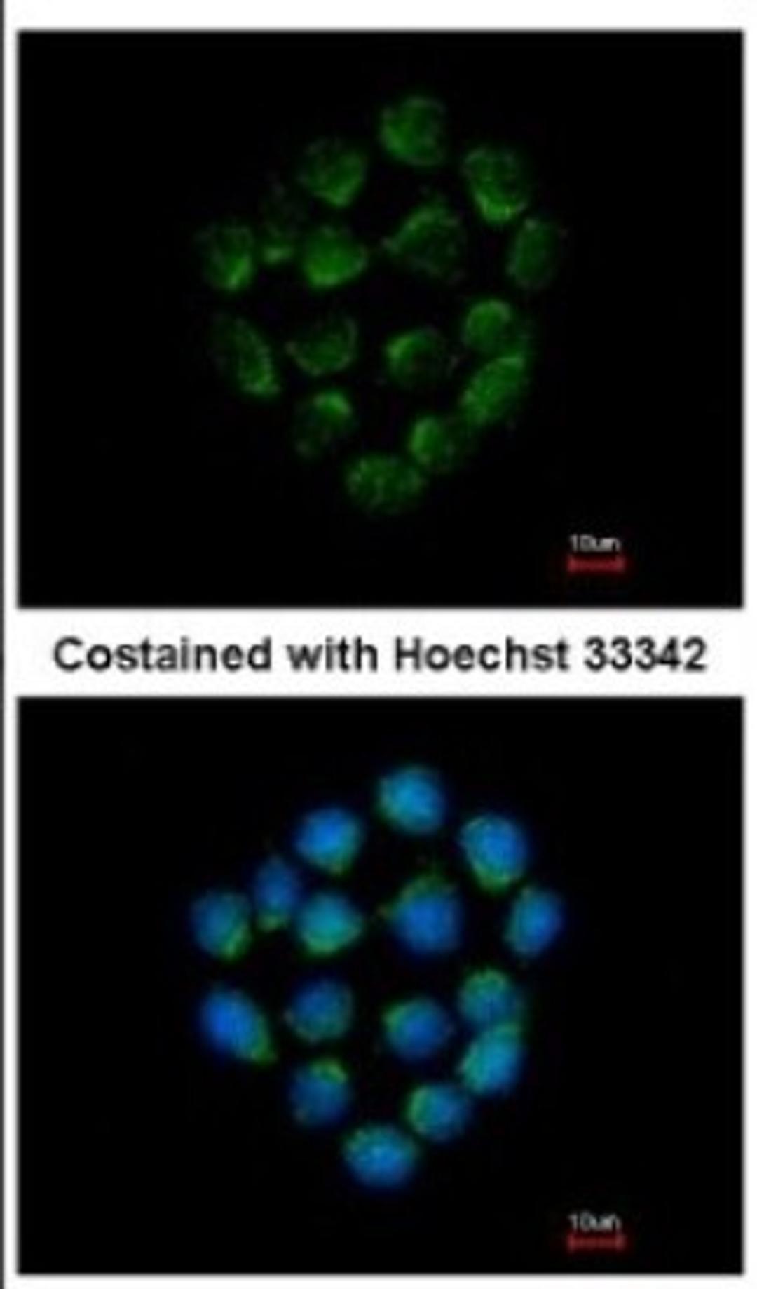 Immunocytochemistry/Immunofluorescence: Cathepsin O Antibody [NBP2-15726] - Immunofluorescence analysis of methanol-fixed HCT116, using antibody at 1:500 dilution.