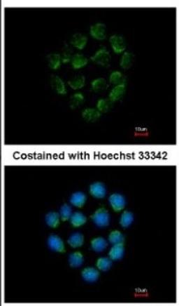 Immunocytochemistry/Immunofluorescence: Cathepsin O Antibody [NBP2-15726] - Immunofluorescence analysis of methanol-fixed HCT116, using antibody at 1:500 dilution.