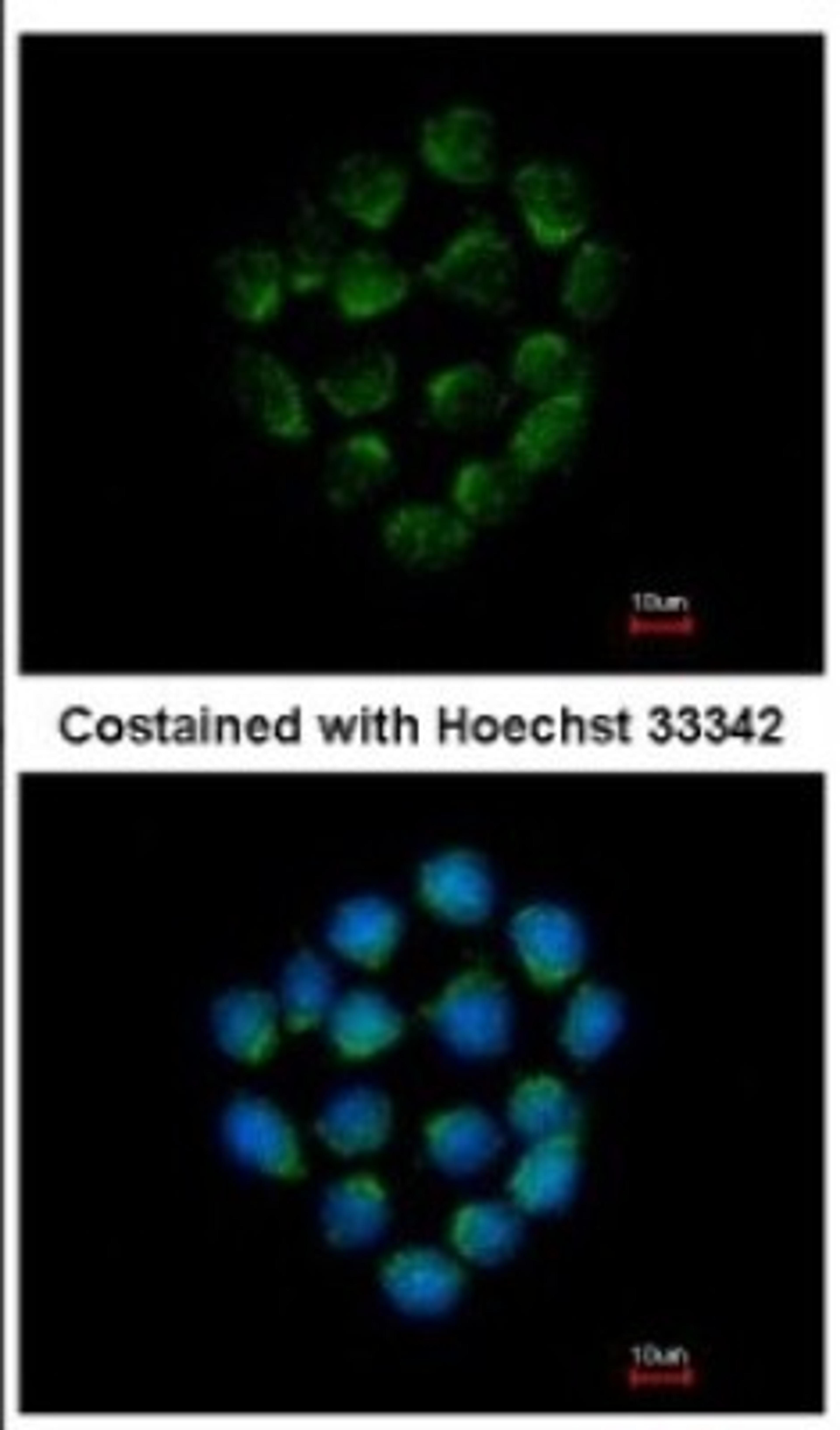 Immunocytochemistry/Immunofluorescence: Cathepsin O Antibody [NBP2-15726] - Immunofluorescence analysis of methanol-fixed HCT116, using antibody at 1:500 dilution.