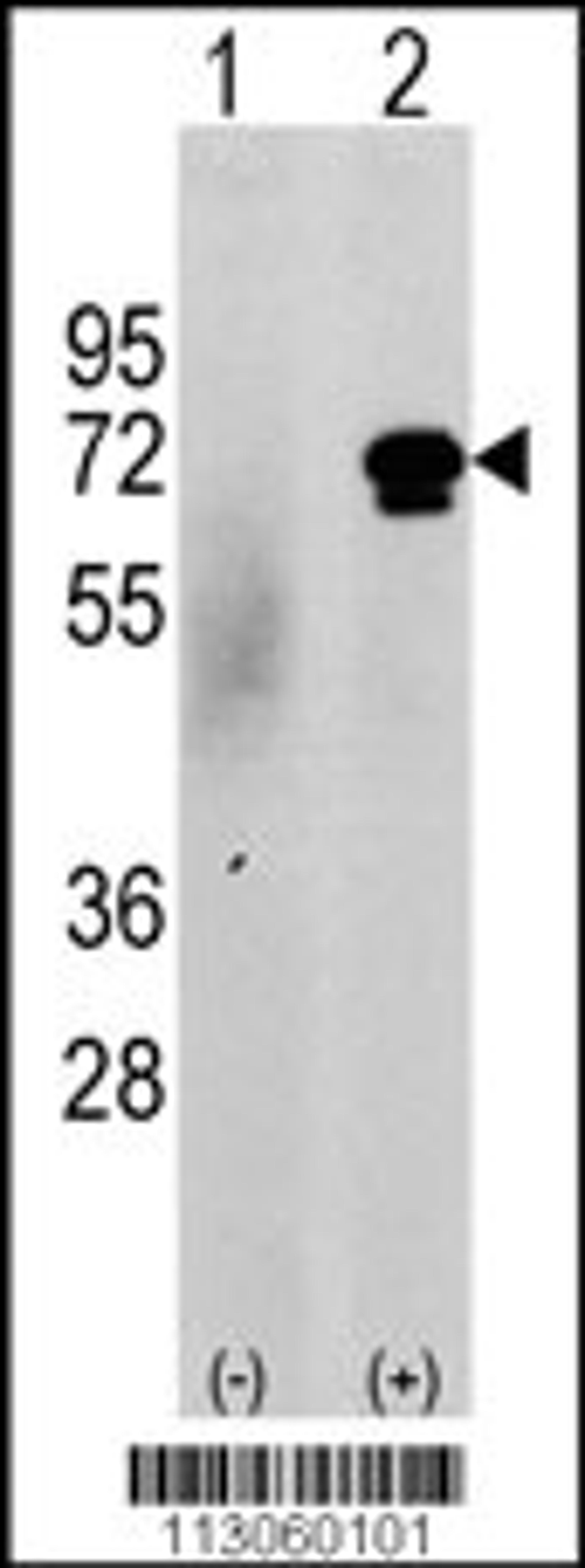 Western blot analysis of CAMKK2 using rabbit polyclonal CAMKK2 Antibody (N-term G67) using 293 cell lysates (2 ug/lane) either nontransfected (c) or transiently transfected with the CAMKK2 gene (Lane 2).