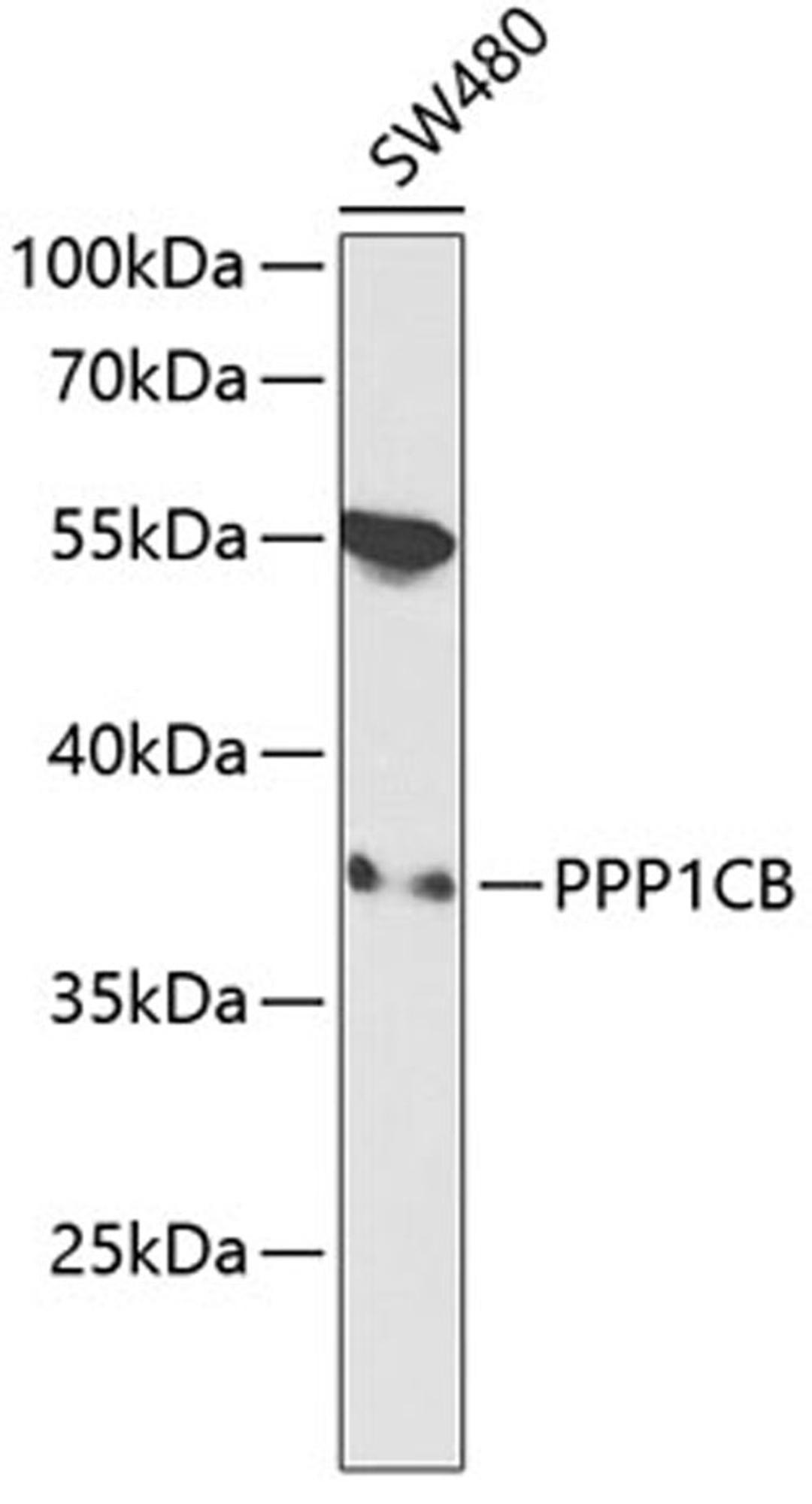 Western blot - PPP1CB antibody (A13529)