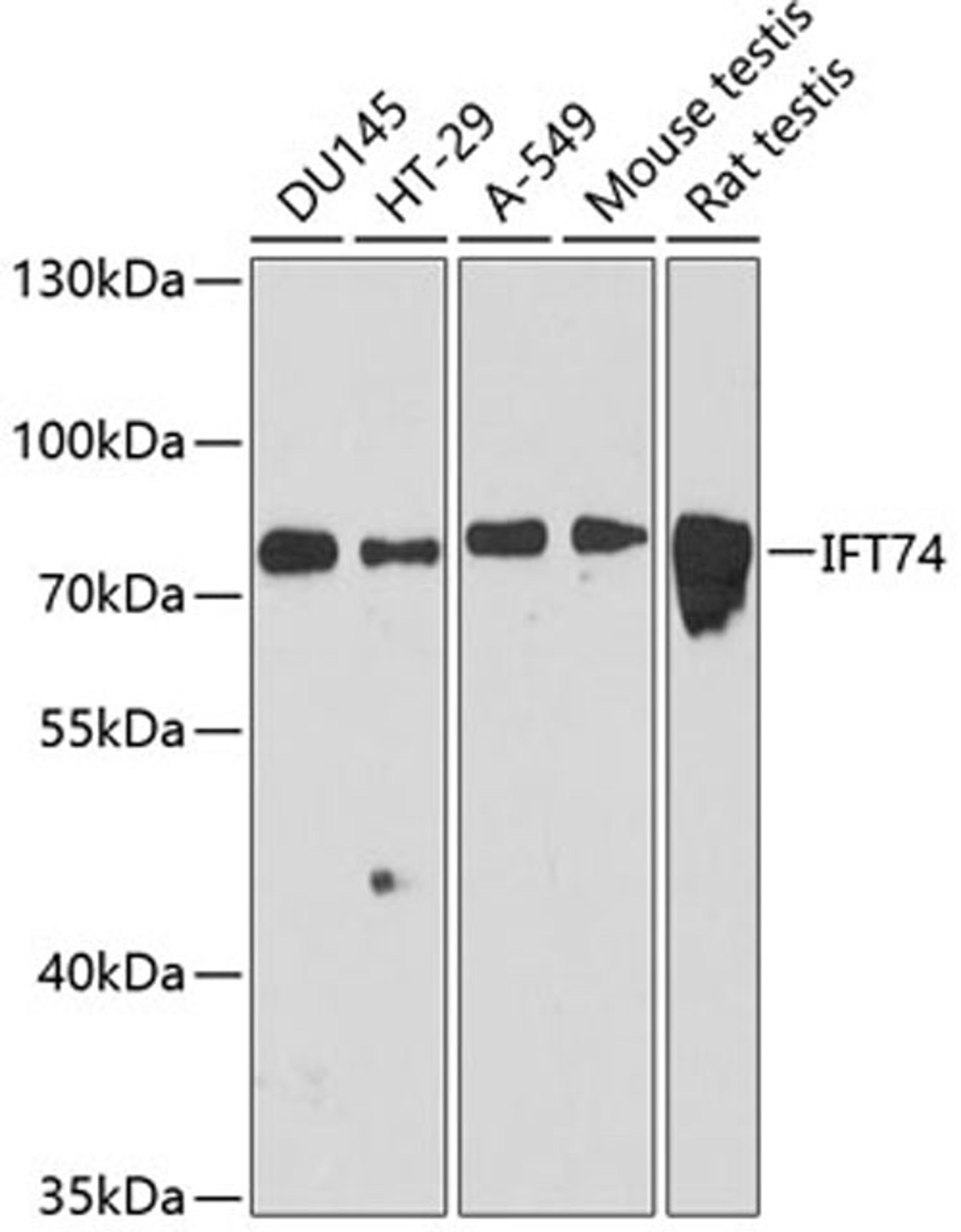 Western blot - IFT74 antibody (A12672)