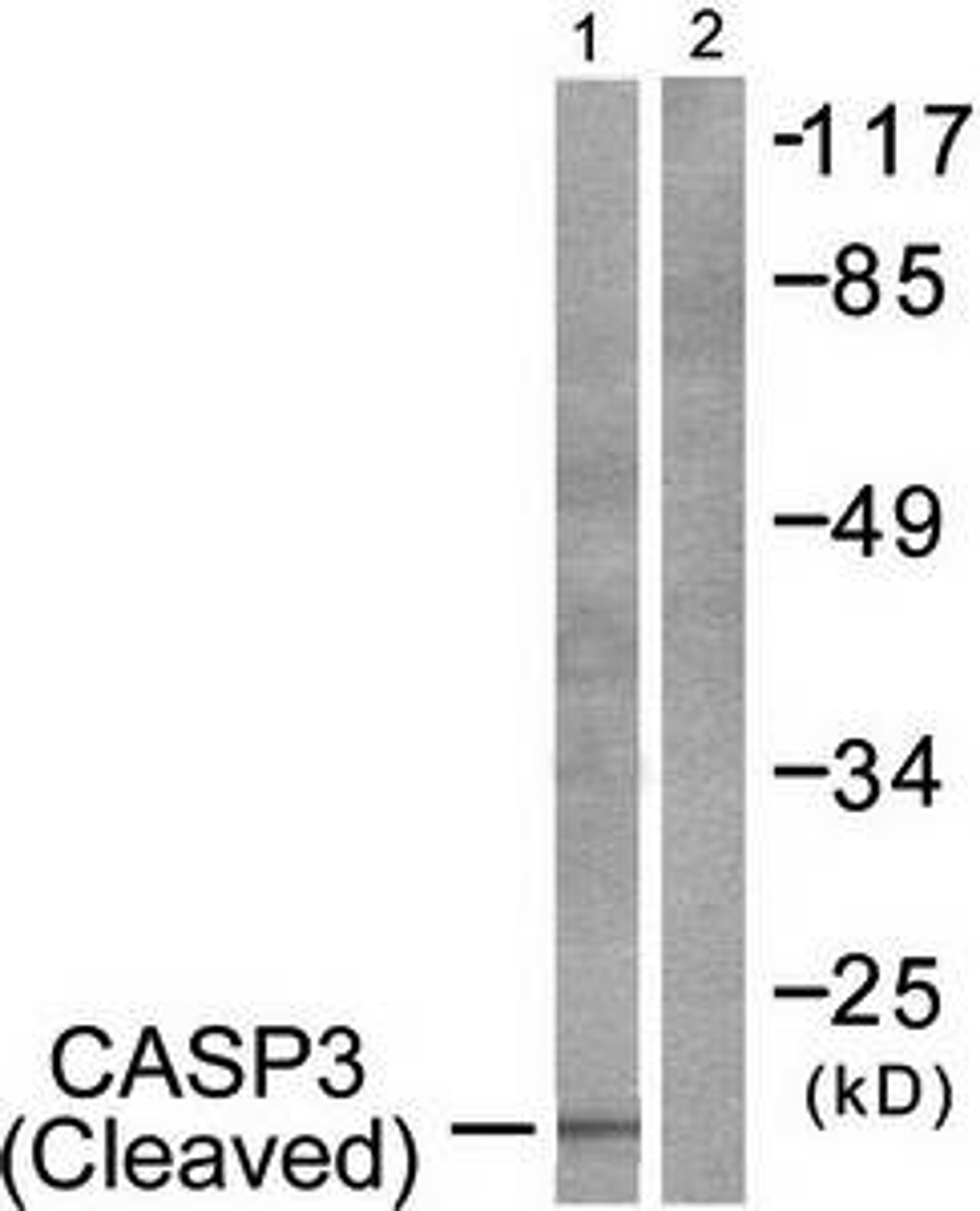 Western blot analysis of extracts from 293 cells treated with Etoposide using Caspase 3 (Cleaved-Asp175) antibody