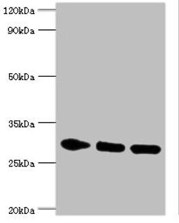Western blot. All lanes: PRKAB2 antibody at 5ug/ml. Lane 1: Rat brain tissue. Lane 2: Mouse heart tissue. Lane 3: Mouse gonad tissue. Secondary. Goat polyclonal to rabbit IgG at 1/10000 dilution. Predicted band size: 31, 22 kDa. Observed band size: 31 kDa. 