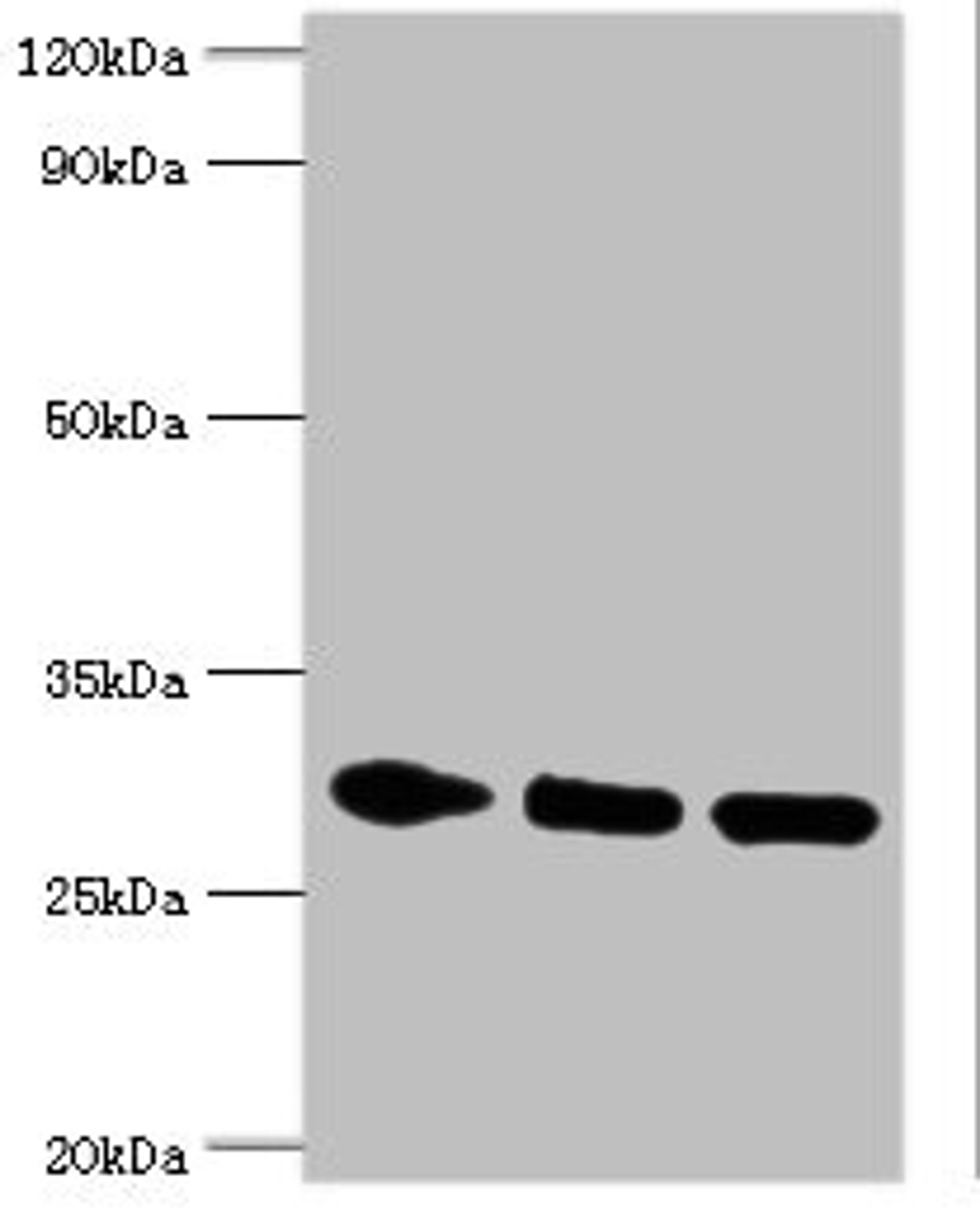 Western blot. All lanes: PRKAB2 antibody at 5ug/ml. Lane 1: Rat brain tissue. Lane 2: Mouse heart tissue. Lane 3: Mouse gonad tissue. Secondary. Goat polyclonal to rabbit IgG at 1/10000 dilution. Predicted band size: 31, 22 kDa. Observed band size: 31 kDa. 