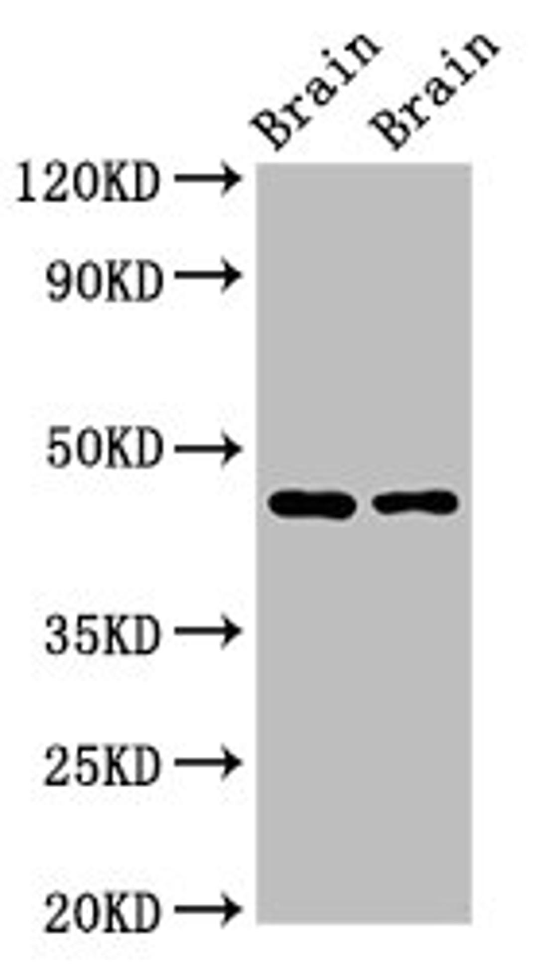 Western Blot. Positive WB detected in: Rat brain tissue, Mouse brain tissue. All lanes: SOX11 antibody at 2.7ug/ml. Secondary. Goat polyclonal to rabbit IgG at 1/50000 dilution. Predicted band size: 47 kDa. Observed band size: 47 kDa.