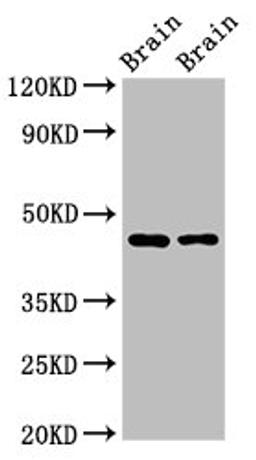 Western Blot. Positive WB detected in: Rat brain tissue, Mouse brain tissue. All lanes: SOX11 antibody at 2.7ug/ml. Secondary. Goat polyclonal to rabbit IgG at 1/50000 dilution. Predicted band size: 47 kDa. Observed band size: 47 kDa.