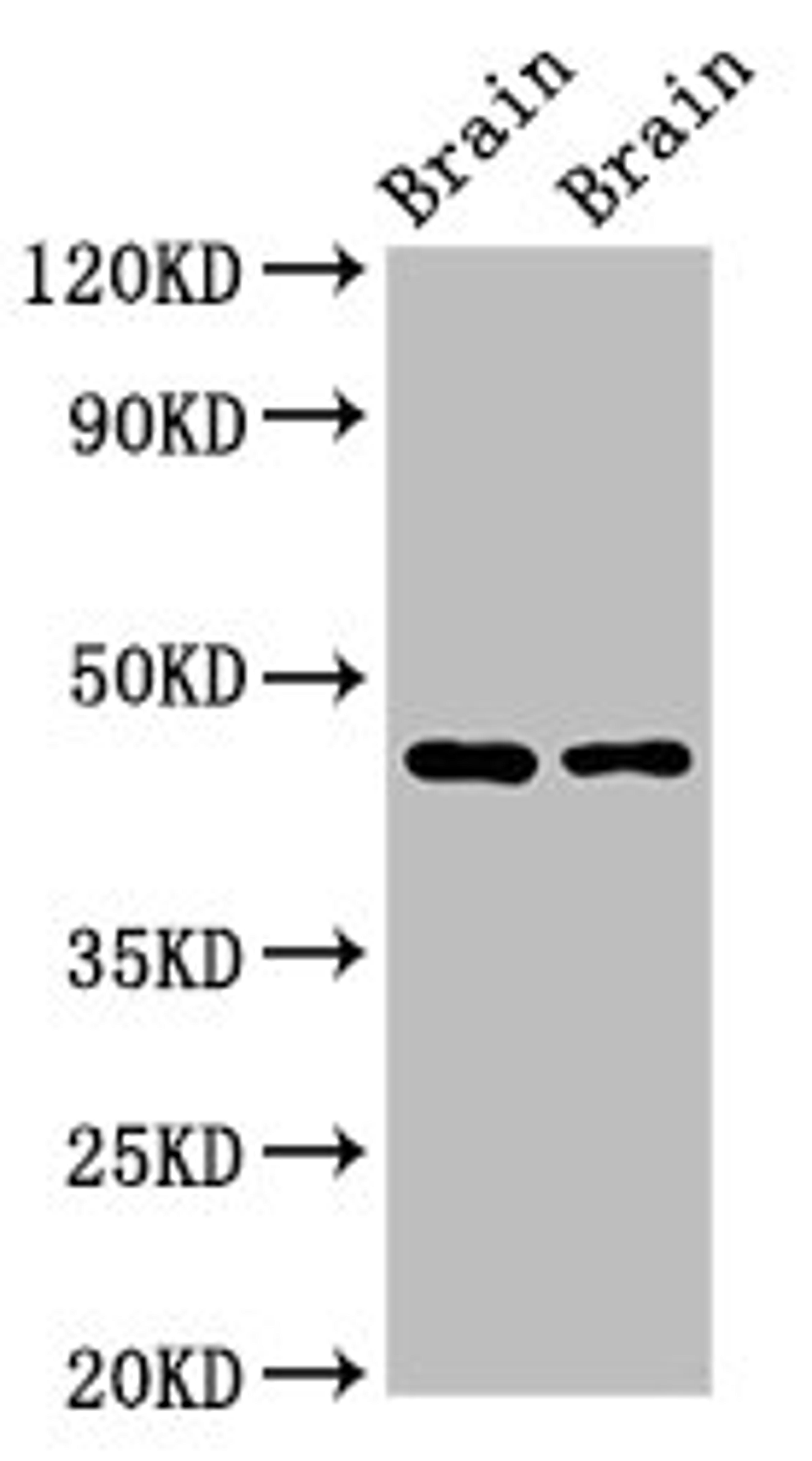 Western Blot. Positive WB detected in: Rat brain tissue, Mouse brain tissue. All lanes: SOX11 antibody at 2.7ug/ml. Secondary. Goat polyclonal to rabbit IgG at 1/50000 dilution. Predicted band size: 47 kDa. Observed band size: 47 kDa.