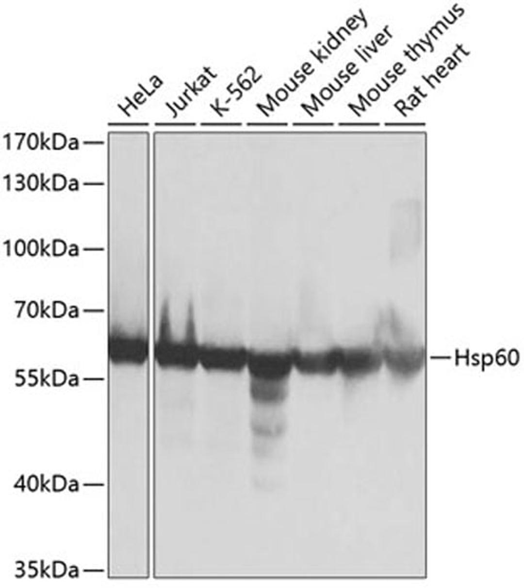 Western blot - Hsp60 antibody (A0969)