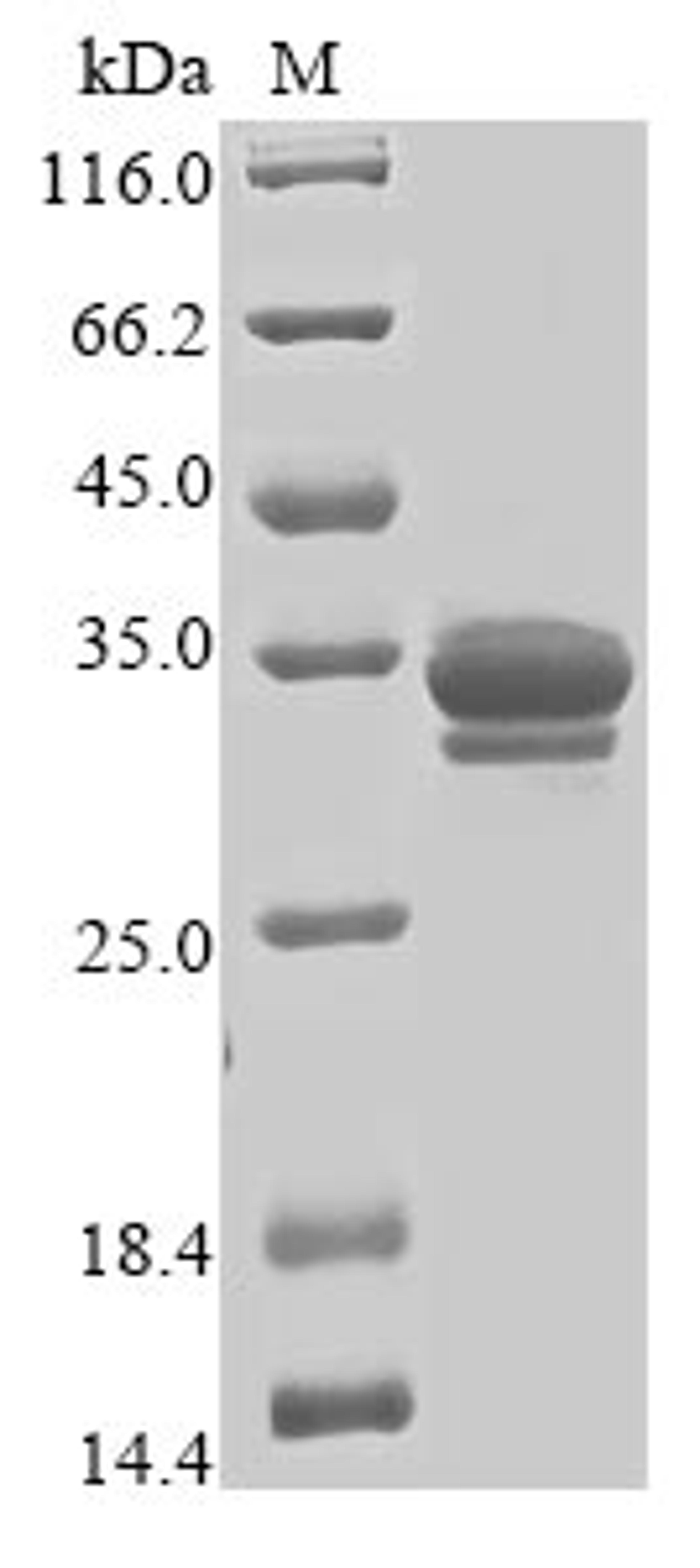 (Tris-Glycine gel) Discontinuous SDS-PAGE (reduced) with 5% enrichment gel and 15% separation gel.