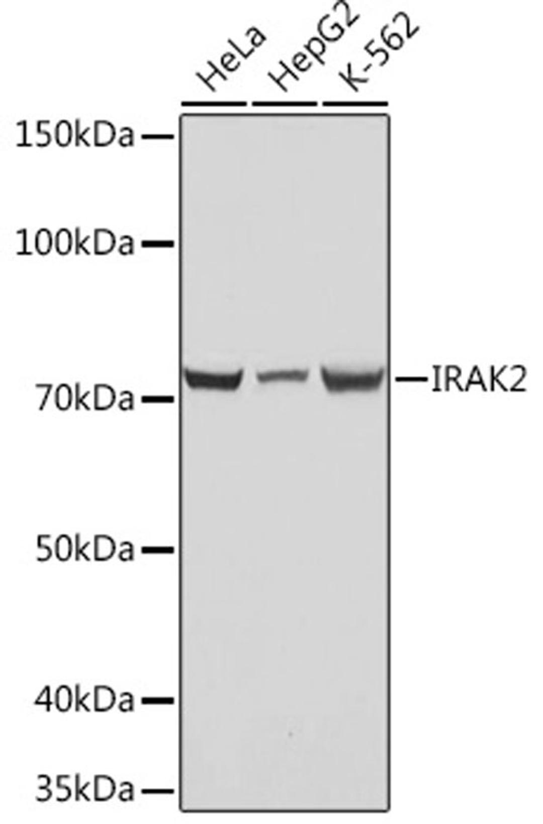 Western blot - IRAK2 Rabbit mAb (A4655)