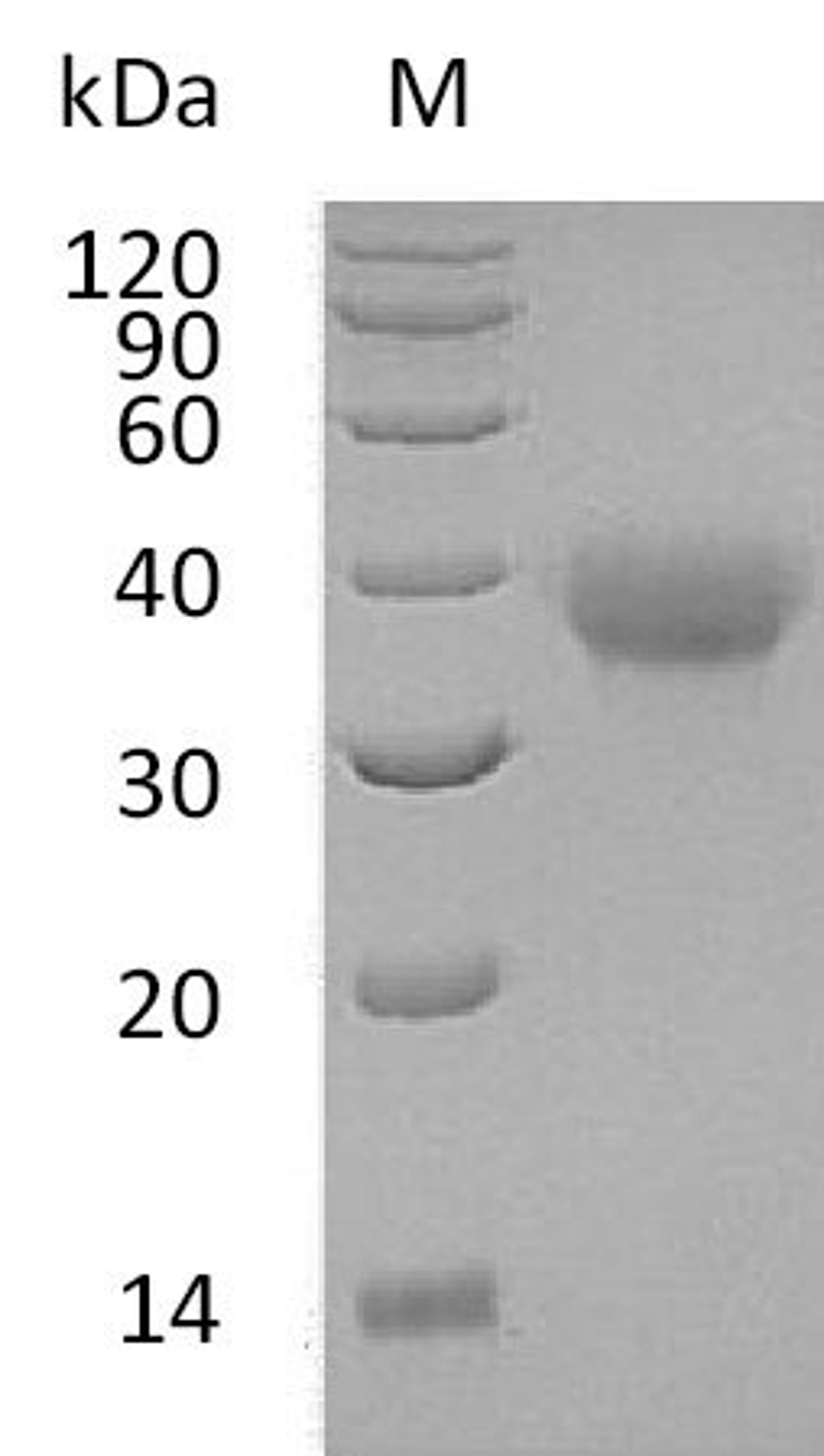(Tris-Glycine gel) Discontinuous SDS-PAGE (reduced) with 5% enrichment gel and 15% separation gel.