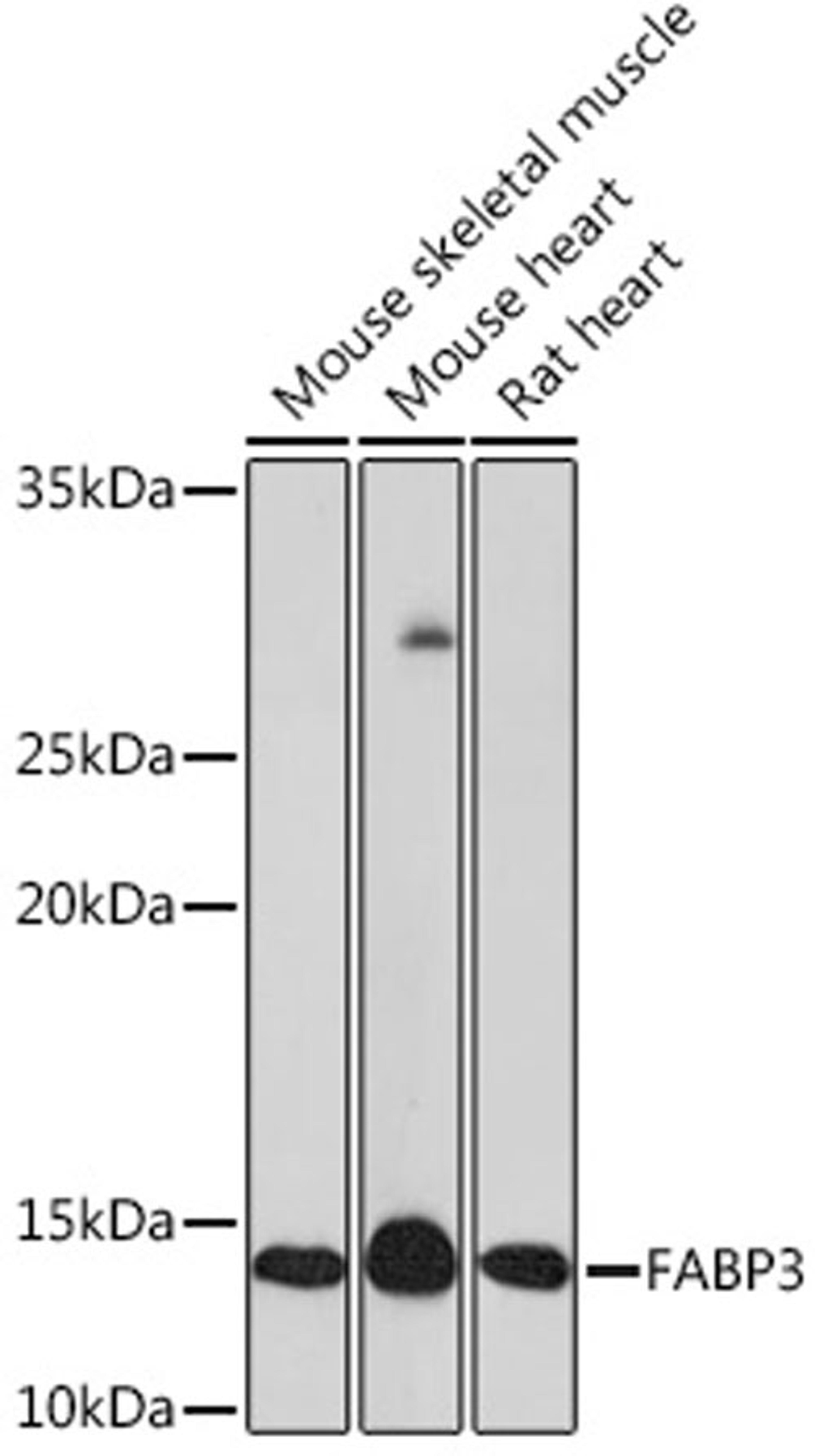 Western blot - FABP3 Rabbit mAb (A8789)