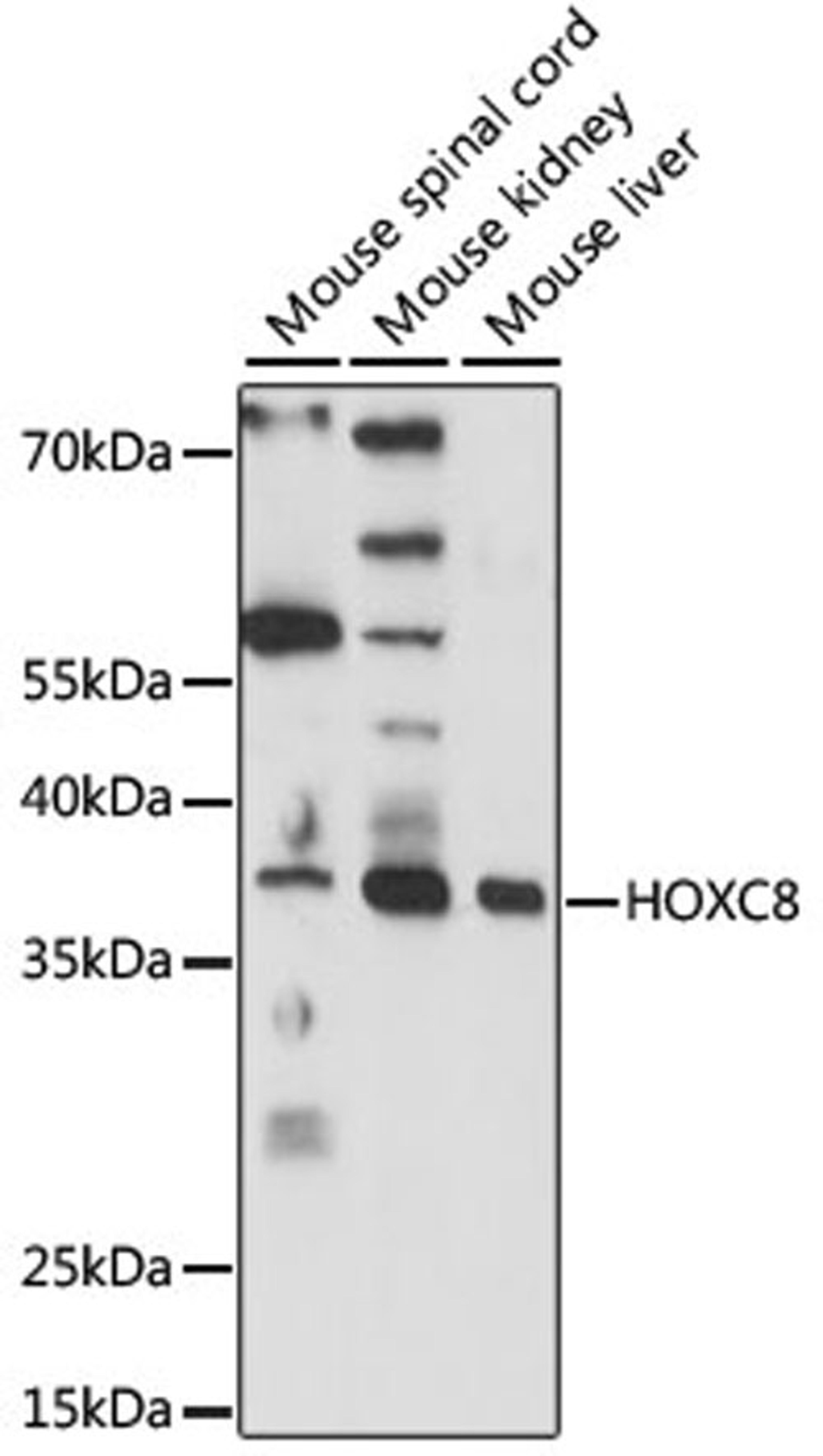 Western blot - HOXC8 antibody (A15066)