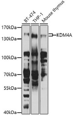 Western blot - KDM4A antibody (A7953)