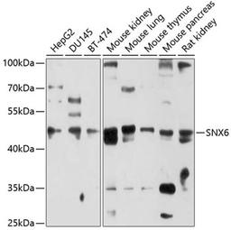 Western blot - SNX6 antibody (A10039)