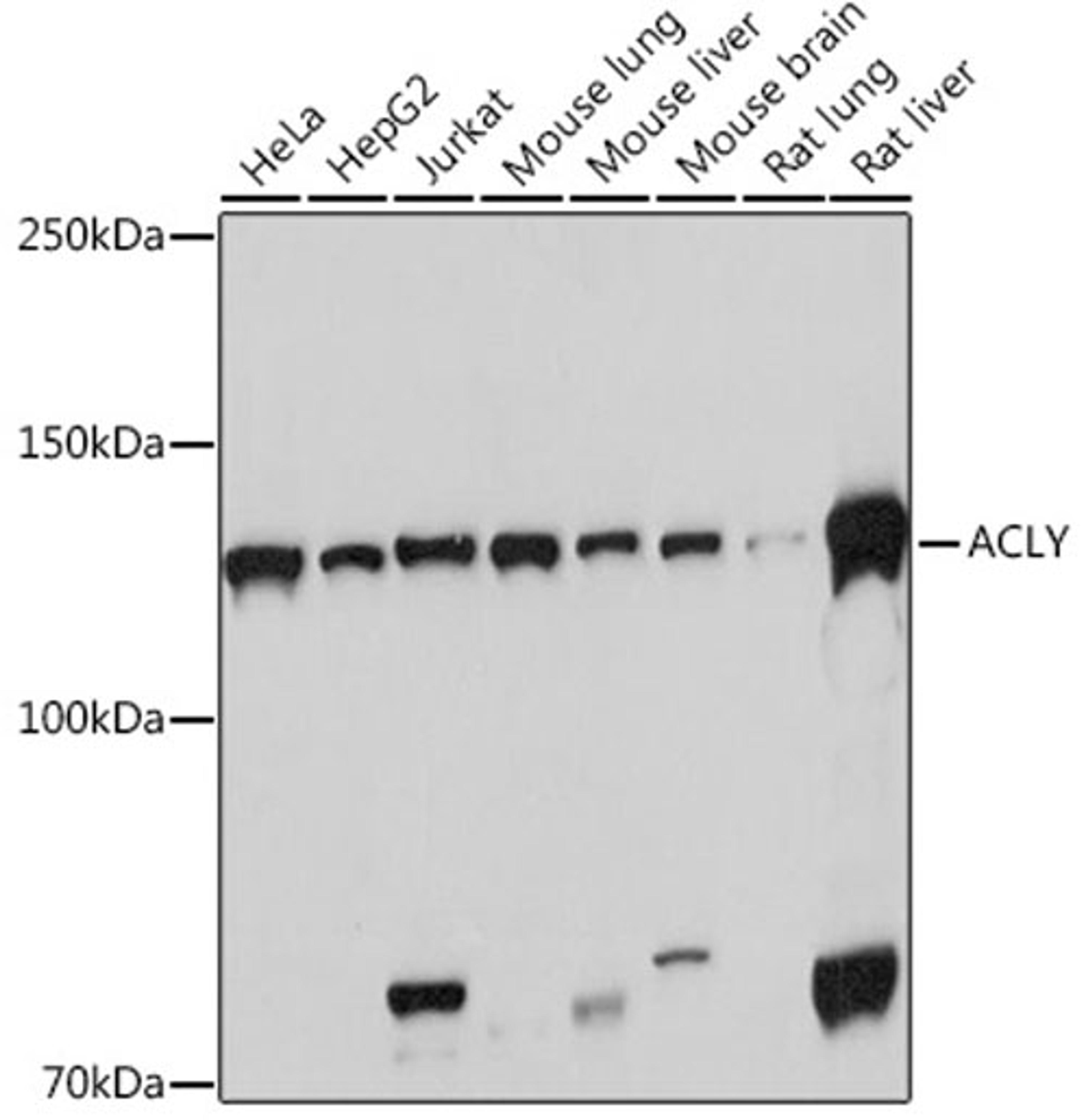 Western blot - ACLY Rabbit mAb (A3719)