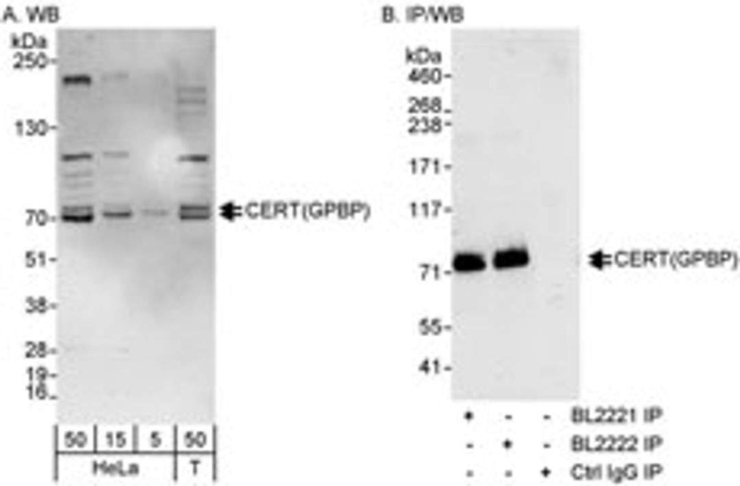 Detection of human CERT(GPBP) by western blot and immunoprecipitation.