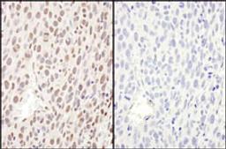 Detection of mouse Phospho RelA (S468) by immunohistochemistry.