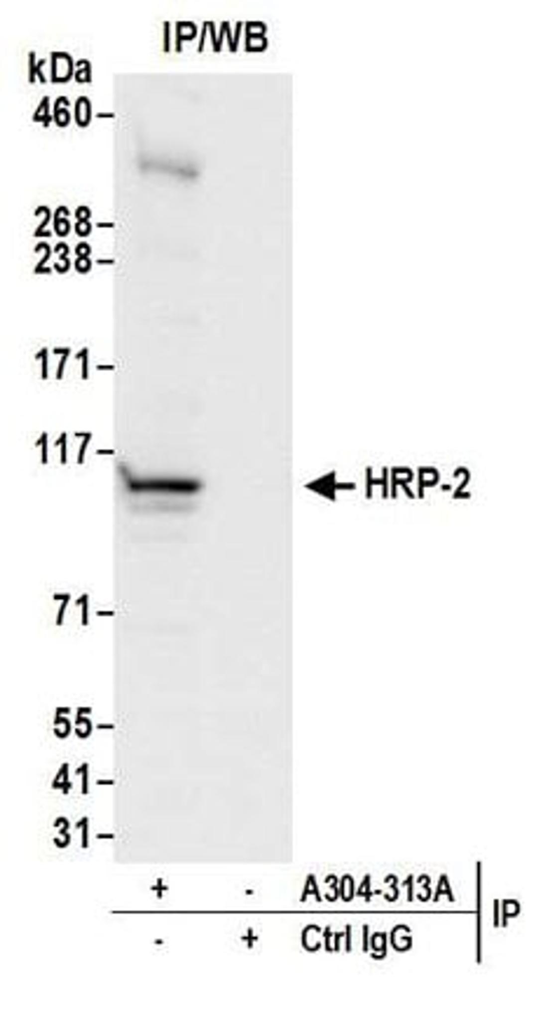 Detection of human HRP-2 by western blot of immunoprecipitates.