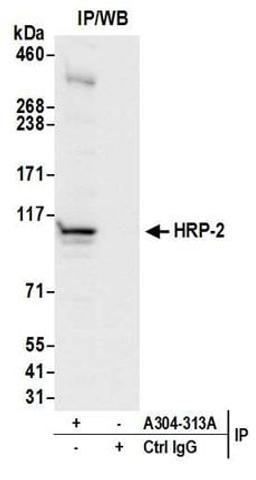 Detection of human HRP-2 by western blot of immunoprecipitates.