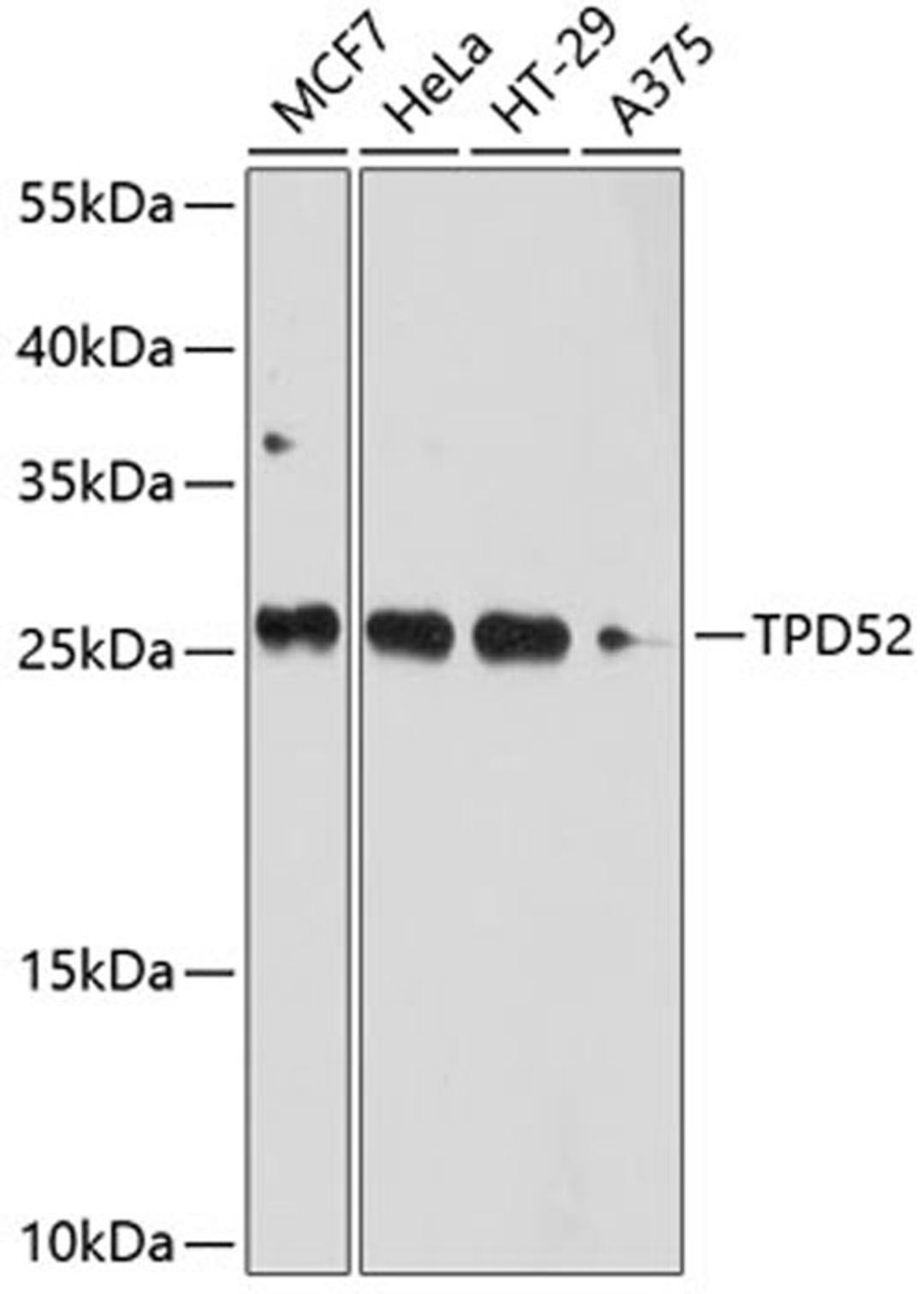 Western blot - TPD52 antibody (A10254)