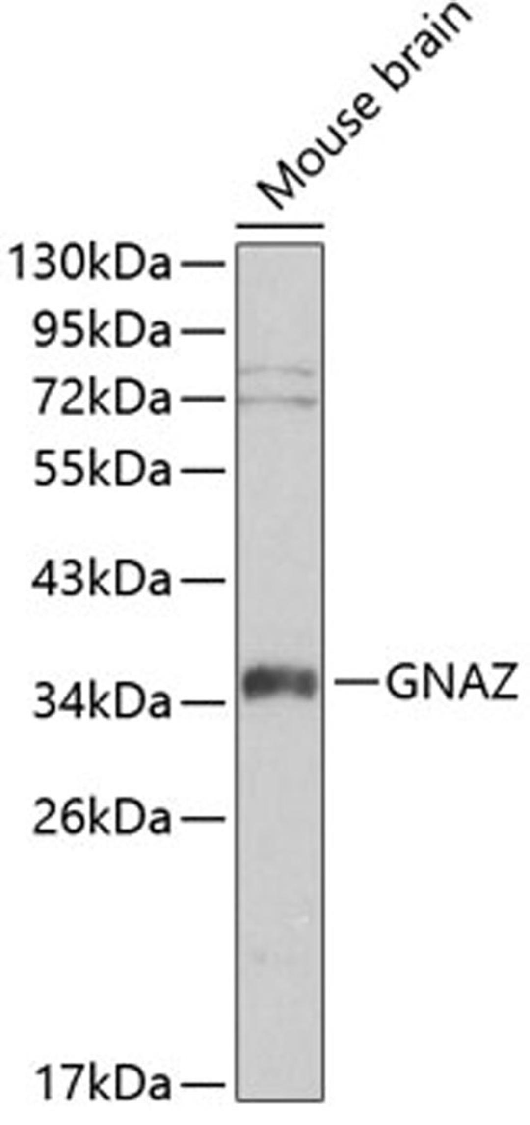 Western blot - GNAZ antibody (A0605)