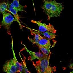 Immunofluorescence analysis of neuroblastoma cell line sk-n-be using Protocadherin Gamma B2 antibody