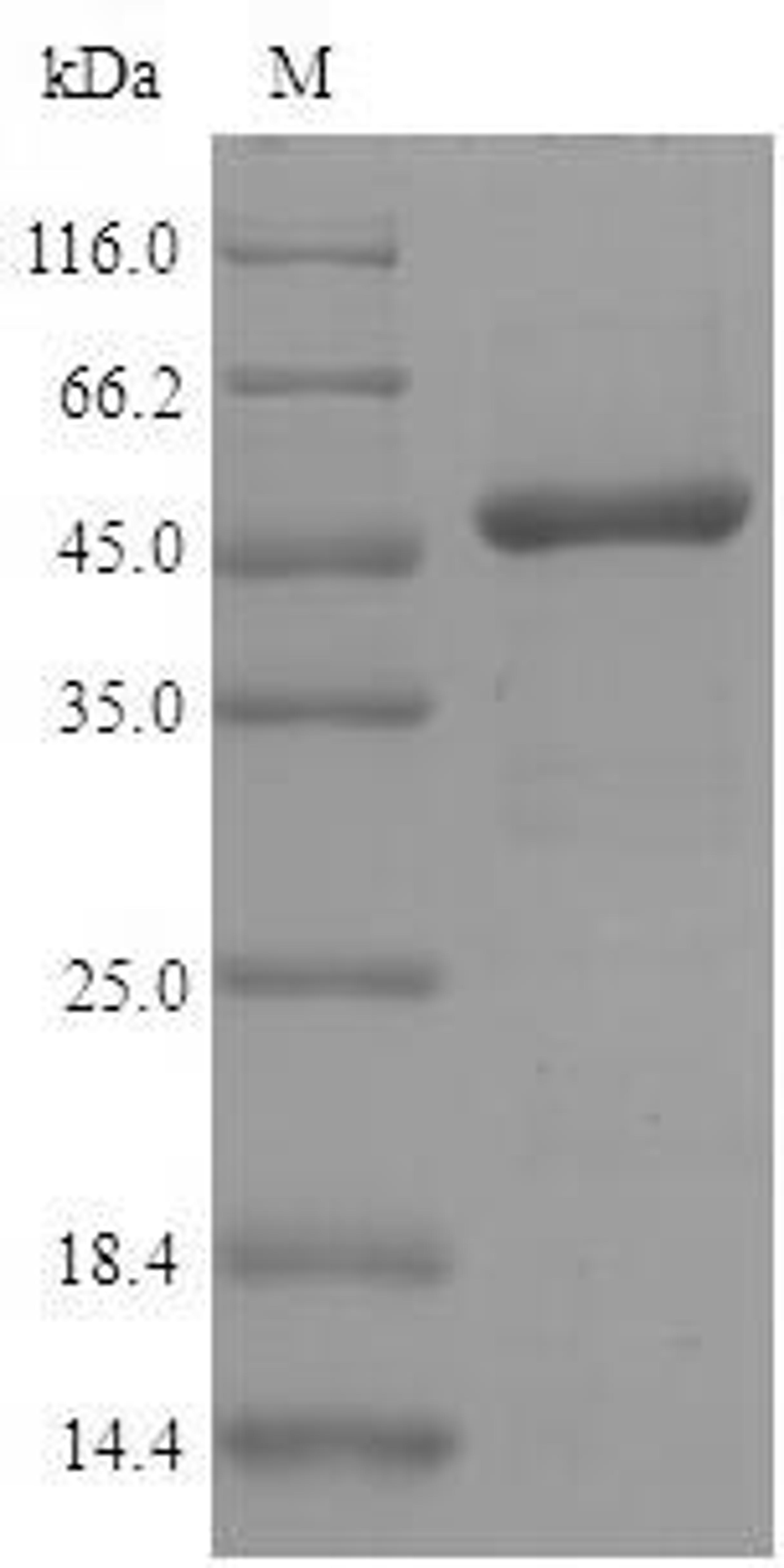 (Tris-Glycine gel) Discontinuous SDS-PAGE (reduced) with 5% enrichment gel and 15% separation gel.