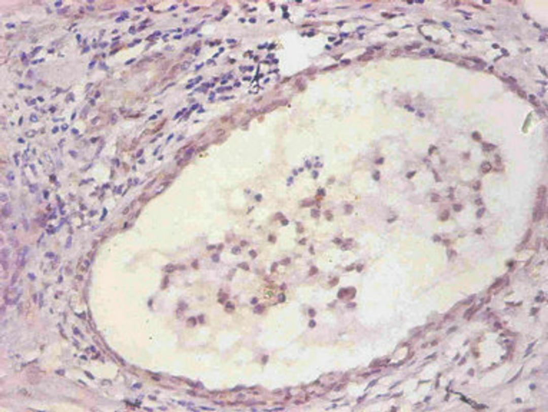 Immunohistochemical of paraffin-embedded human prostate tissue using CSB-MA067571A0m at dilution of 1:200