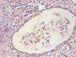 Immunohistochemical of paraffin-embedded human prostate tissue using CSB-MA067571A0m at dilution of 1:200